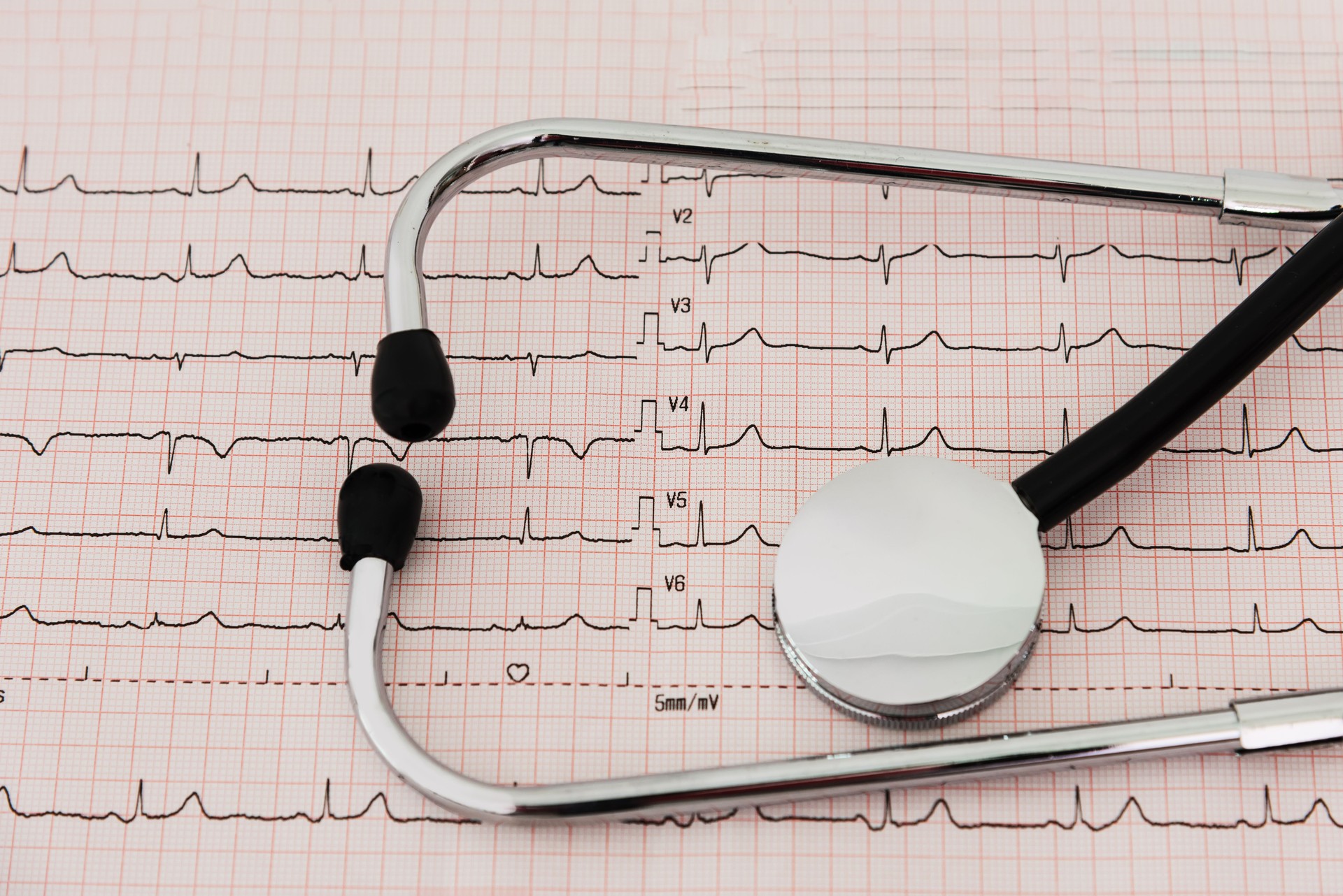 Cardiology stethoscope and chart